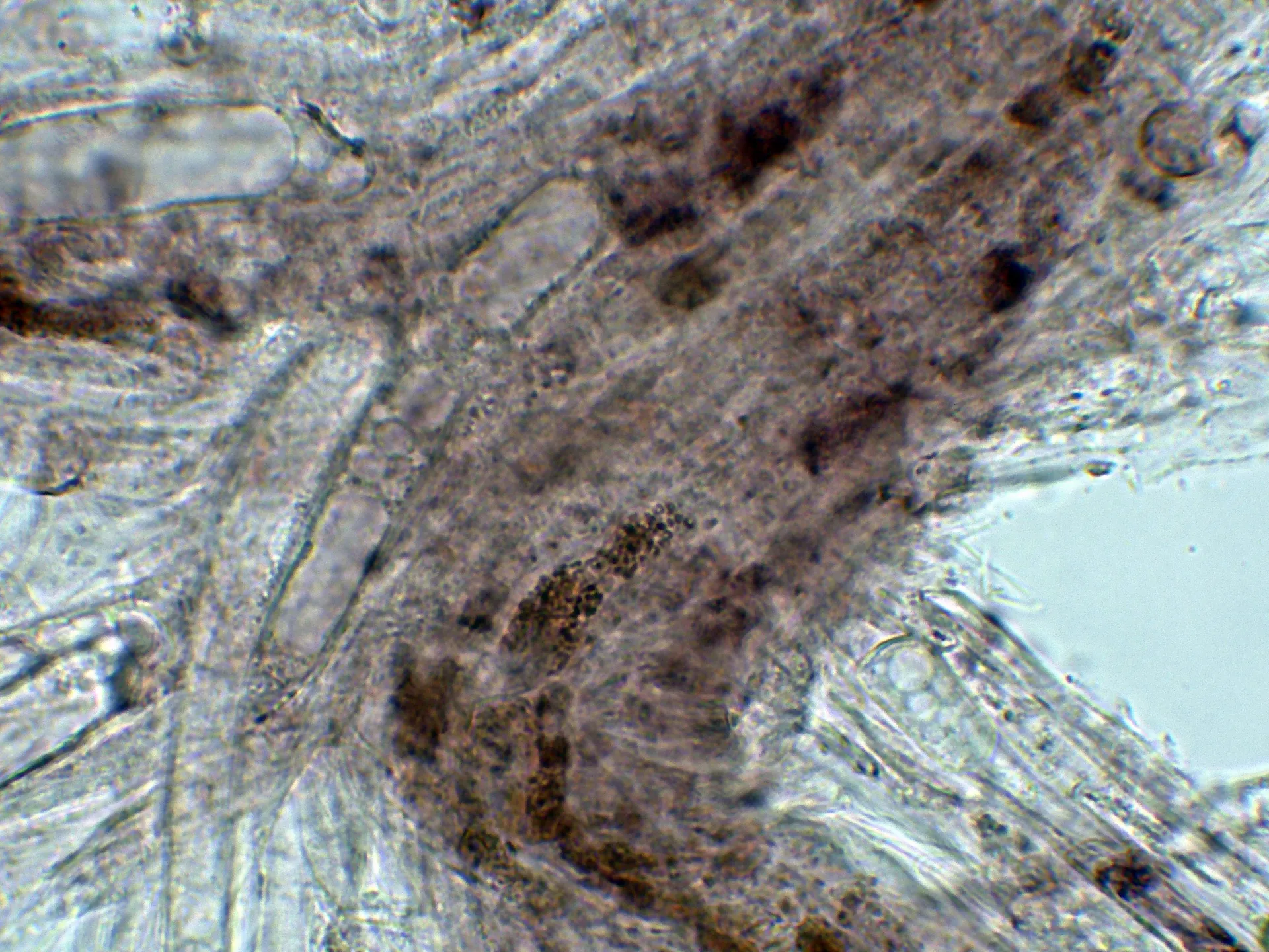 10 - Suprapellis agua-004